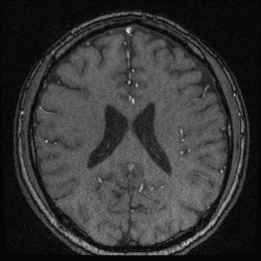 Click on the Serie image to view the images of VILLANUEVA, WILLIAM A.